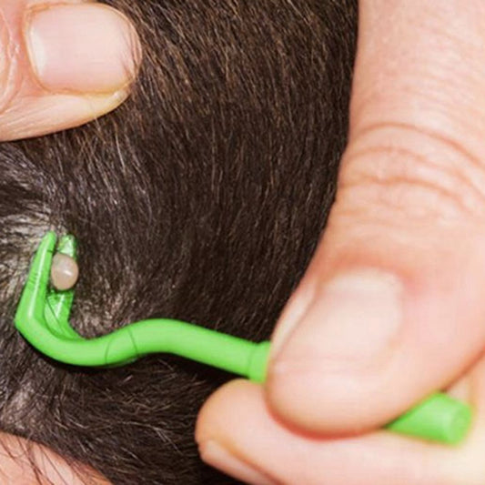 Ticks Removal